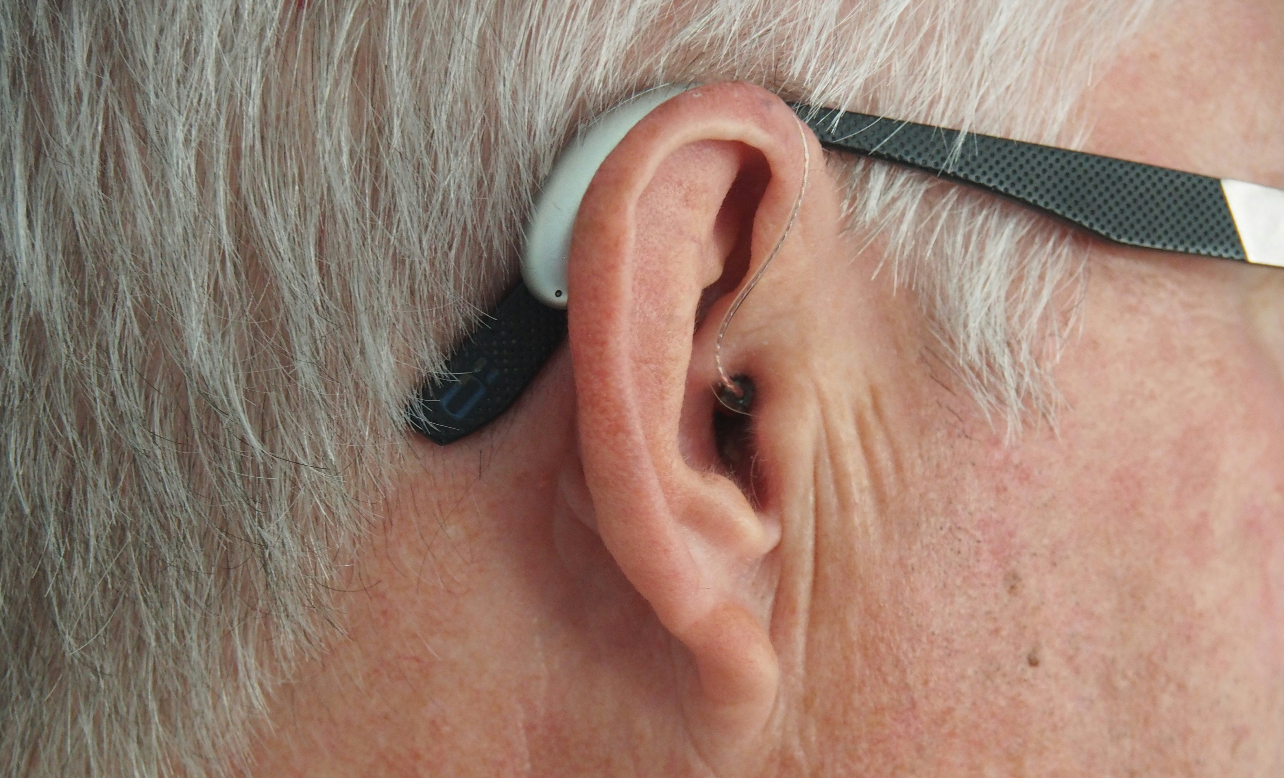 Modern hearing aid fitted on a patient's ear