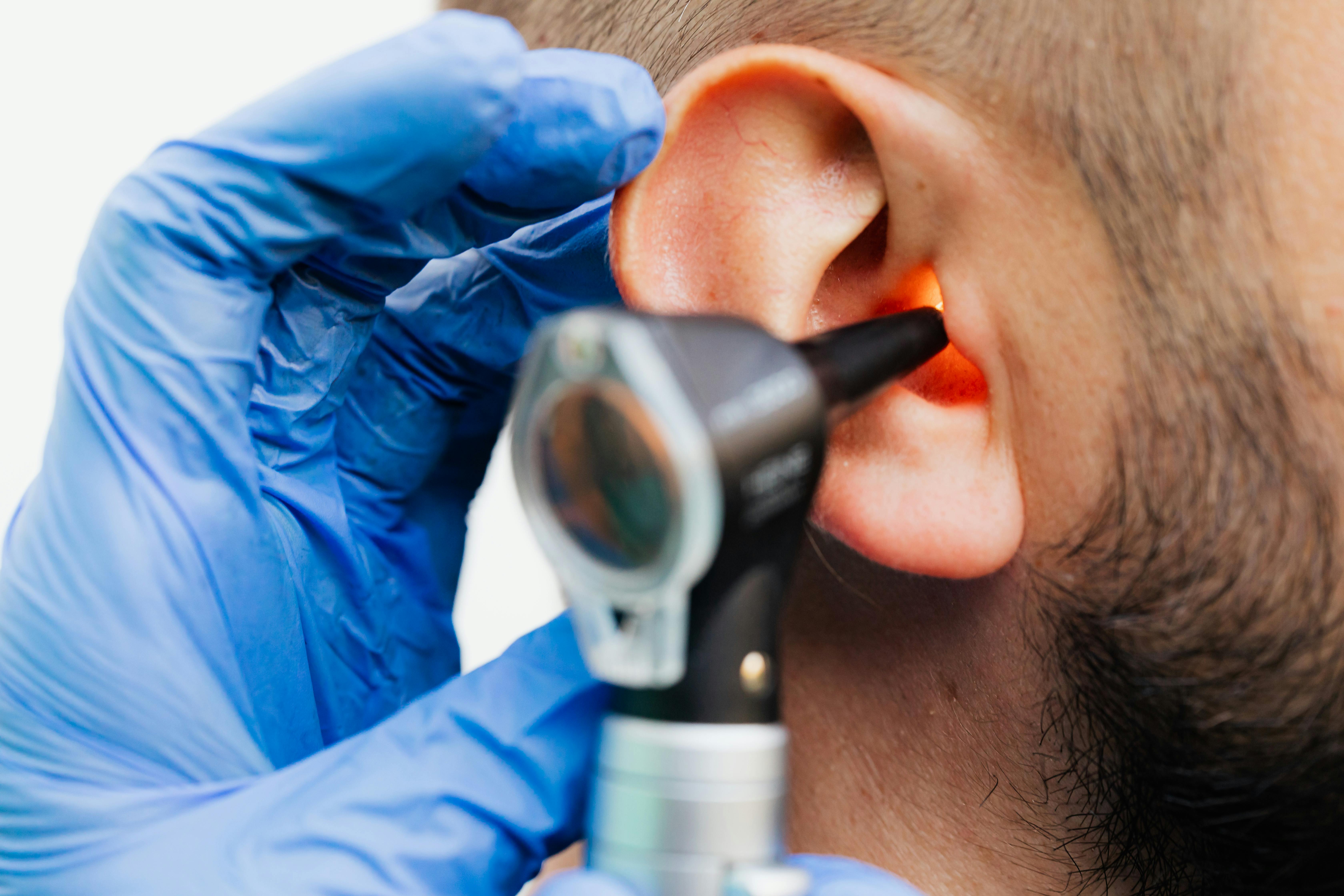 Otoscopic examination being performed by an Audiologist